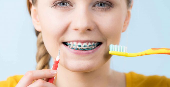 How Do You Maintain Oral Hygiene With Braces – 2024 Guide