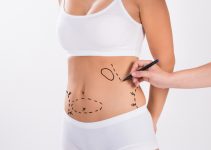 5 Things You Should Avoid Doing bBefore Liposuction