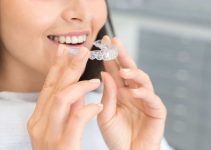 Are Invisible Braces Worth The Extra Cost