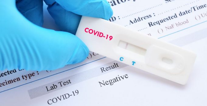 How Reliable Are At-Home Coronavirus Test Kits – 2024 Guide?