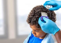 Can Black People Get Lice and Are They Infectious?