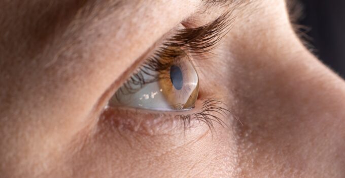 Effective Solutions for Patients Suffering from Keratoconus